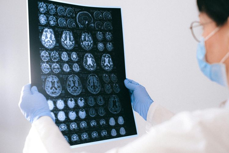 Photo by Anna Shvets: https://www.pexels.com/photo/a-doctor-holding-an-mri-result-of-the-brain-4226219/